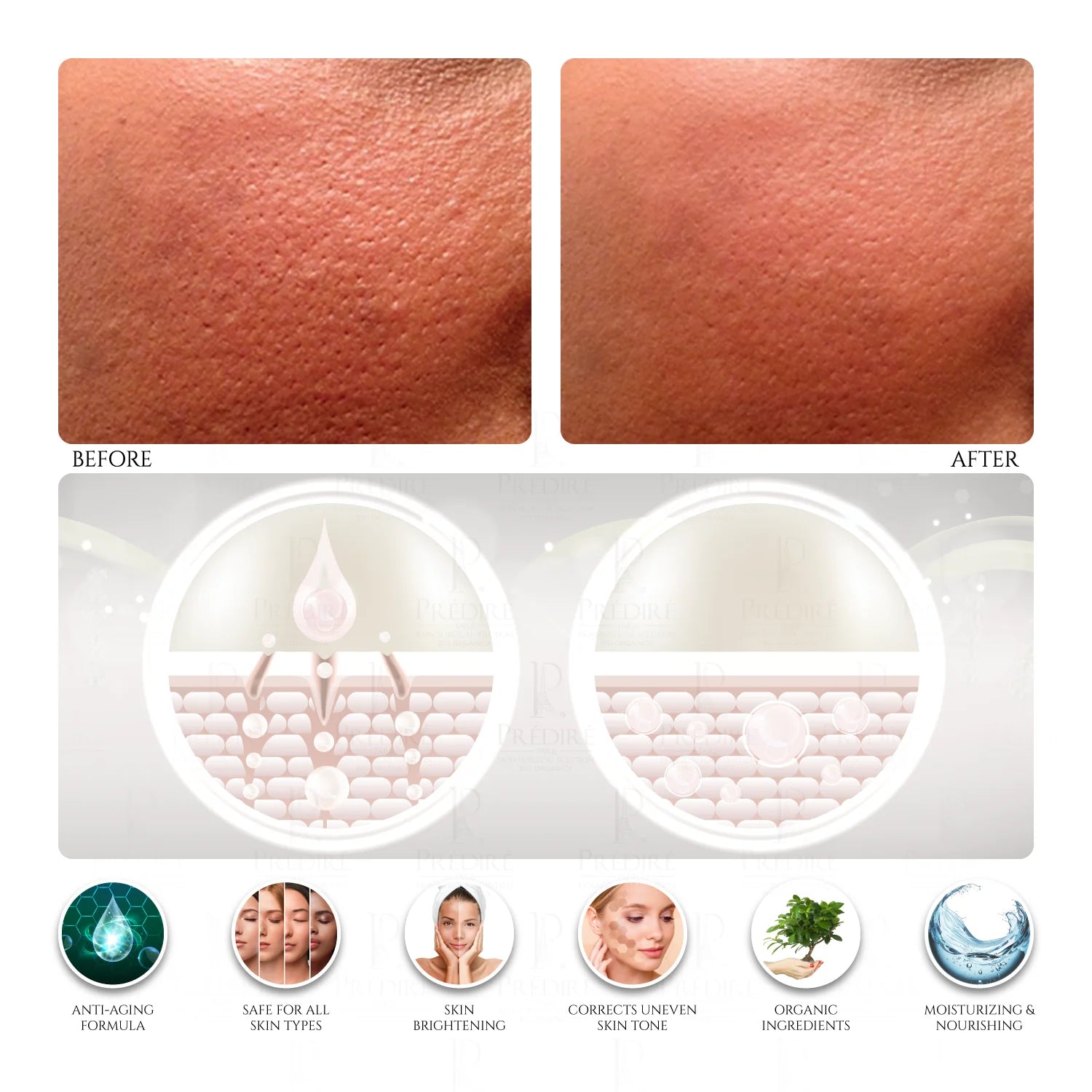 Age-Defying Cell Renewal Thermal Mask Powered by Retinol (Treats Clogged Pores), 50ml