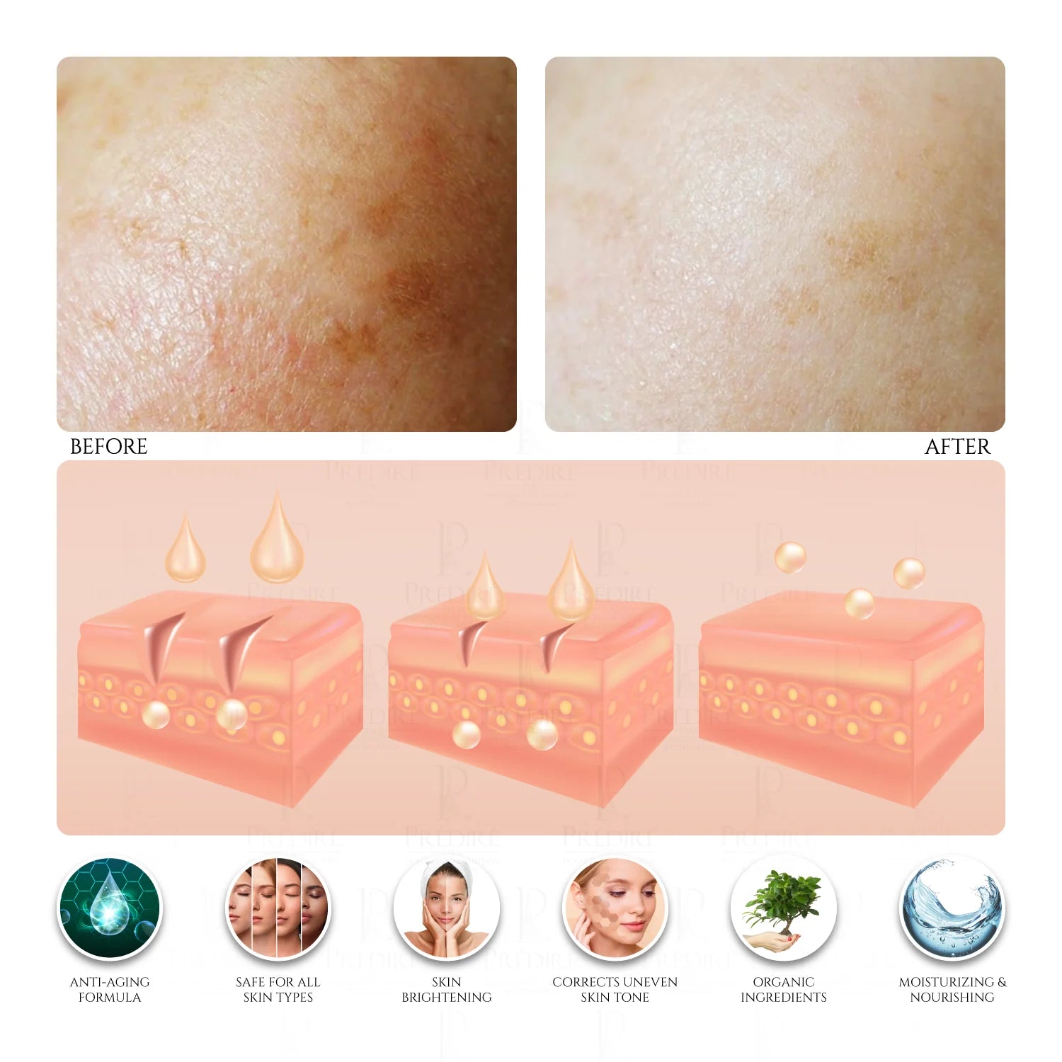 Vitamin C,E &A Booster Facial Peeling Gel, 50mml